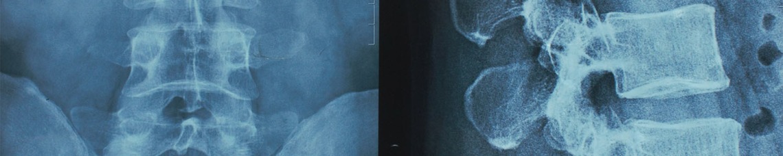 Spine x-ray 