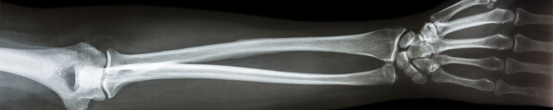 Arm x-ray