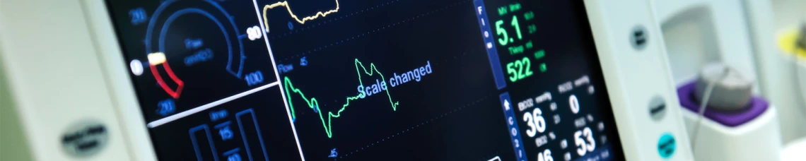 EKG monitor