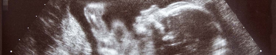 Image of baby ultrasound